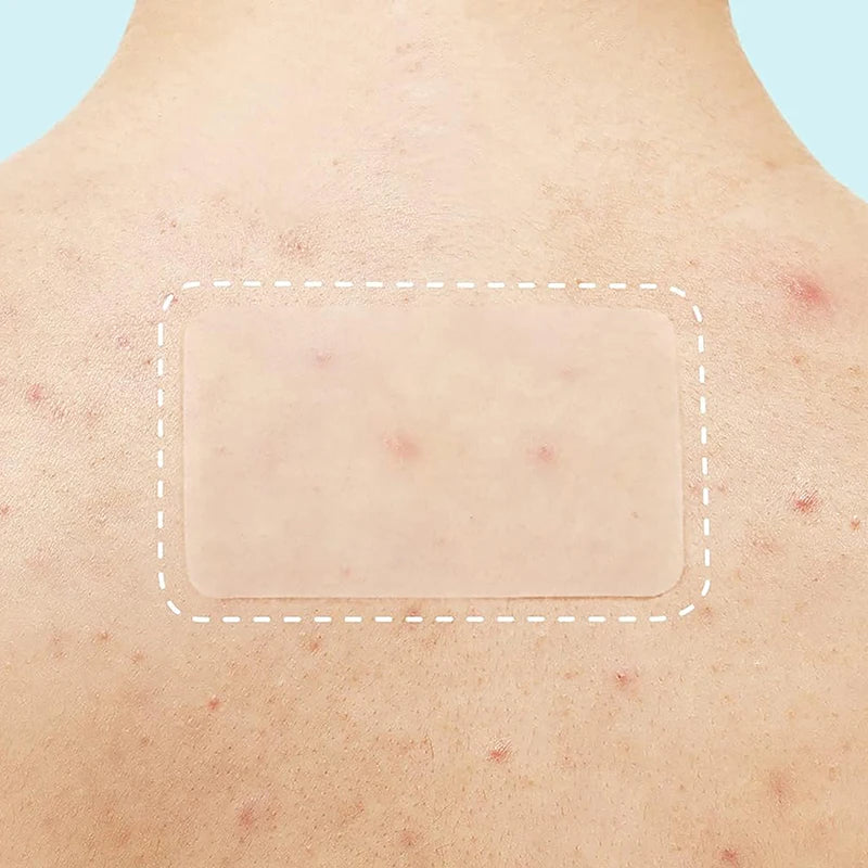 118 PCS/SET Pimple Patch Acne Invisible