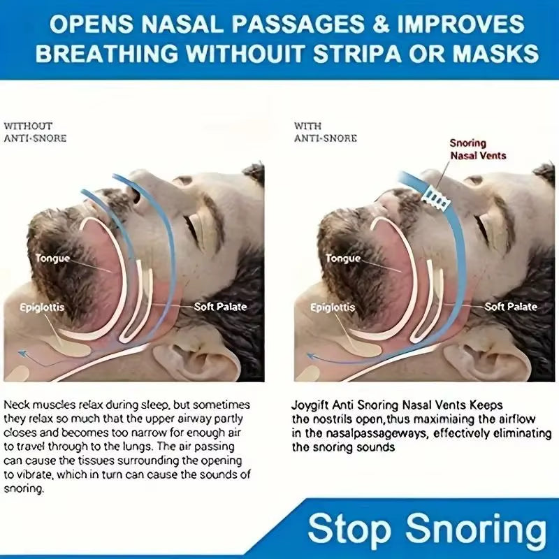 Mini Anti-Snoring Device, Snoring Sleep Anti-Snoring Nose Clip, Anti-Snoring Device, for Better Sleep