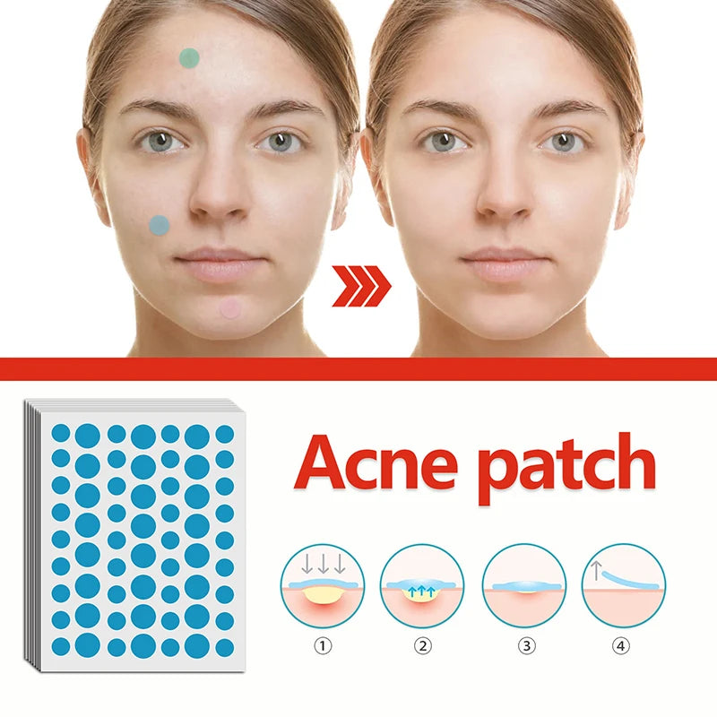 420pcs Pimple Patch Acne Invisible